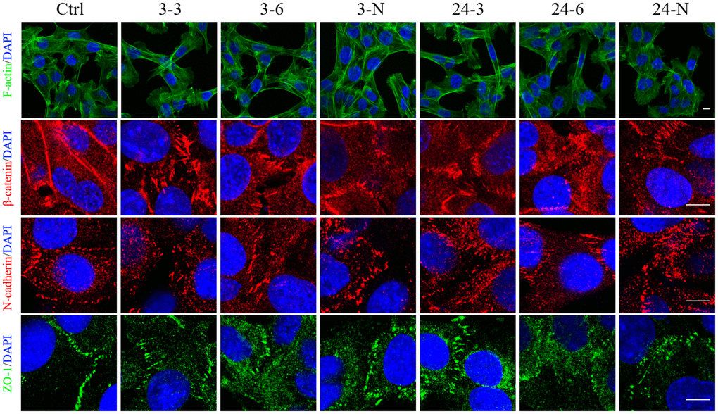 The spatial distributions of F-actin and BTB-associated proteins in TM-4 cells treated with two different concentrations of TiO2-NPs for 24 h. The distribution of intracellular microfilaments (F-actin) and the distribution of BTB-associated proteins: ZO-1 (green), N-cadherin (red), and β-catenin (red). “3–3”: 30 μg/ml, “3–6”: 60 μg/ml, “3-N”: TM-4 cells were treated with 5 mM NAC for 2 h and then treated with 60 μg/ml 3-nm TiO2-NPs for 24 h. “24–3”: 30 μg/ml, “24–6”: 60 μg/ml, "24-N”: TM-4 cells were treated with 5 mM NAC for 2 h and then treated with 60 μg/ml of 24-nm TiO2-NPs for 24 h. Scale bar=10 μm.