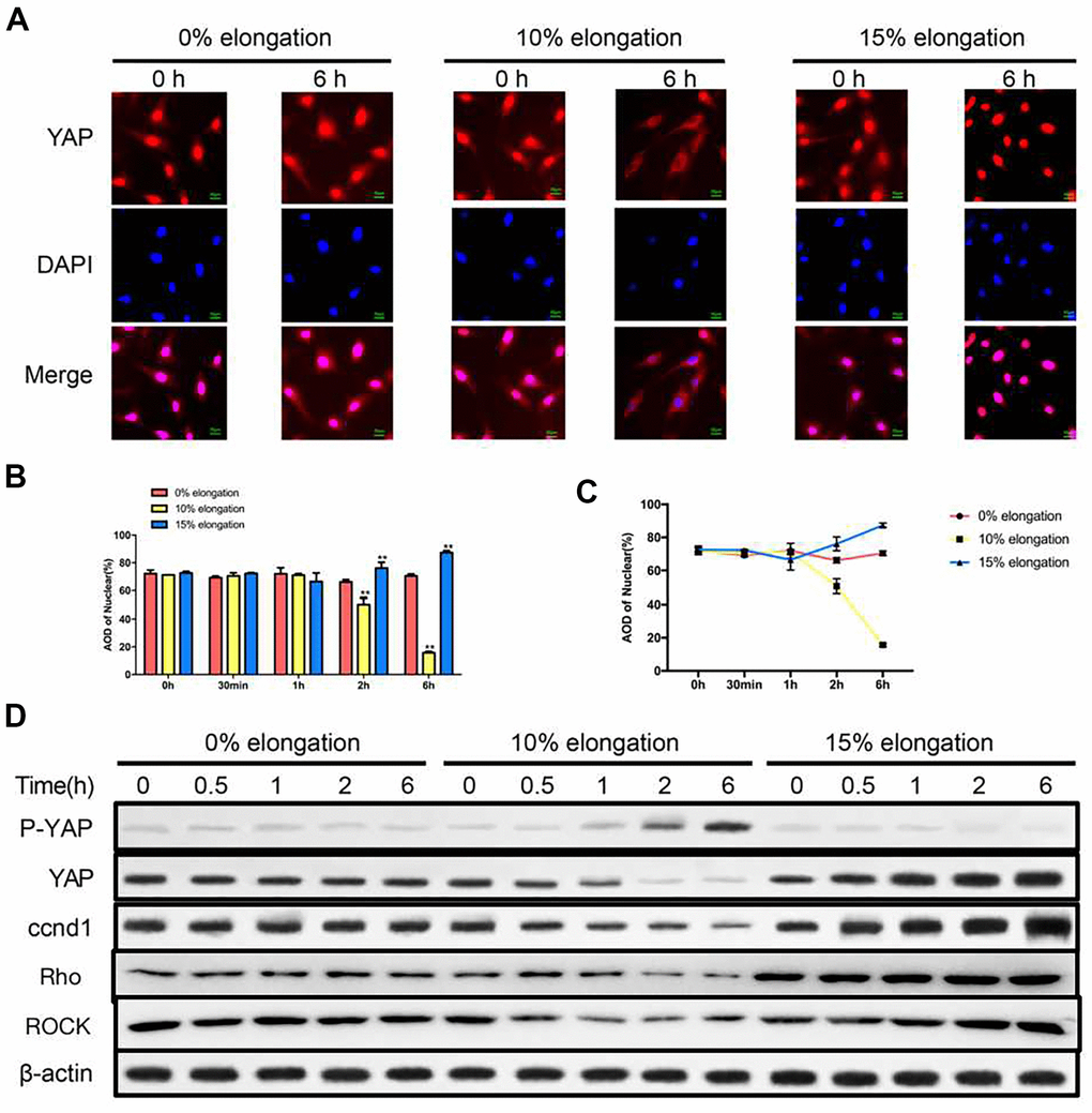 Effects of different intensities of mechanical stress on YAP. (A) The YAP localization of VSMCs was detected by immunocytochemistry. (B, C) Quantification of nuclear YAP amount in VSMCs. (D) The levels of phosphorylated YAP and cyclin D1 (ccnd1) in VSMCs were detected by western blotting. Values are expressed as means±SD. **P 