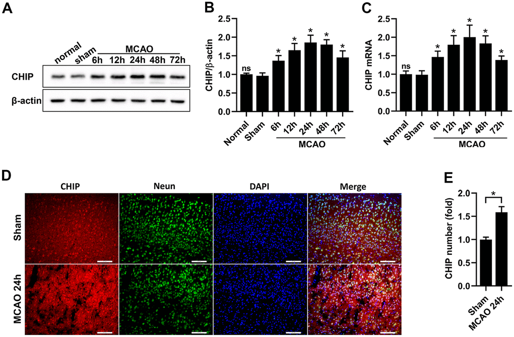 CHIP levels were increased after MCAO. (A, B) Western blot and quantitative analysis of CHIP at different time points after reperfusion in the sham and MCAO surgery groups. (C) The mRNA expression of CHIP. (D, E) Immunostaining and quantitative analysis of CHIP at 24 h after reperfusion in the sham and MCAO surgery groups. Scale bar =100 μm. Data are presented as the mean ± SEM; n=6/group; ns, no significant difference vs. sham group; *P 