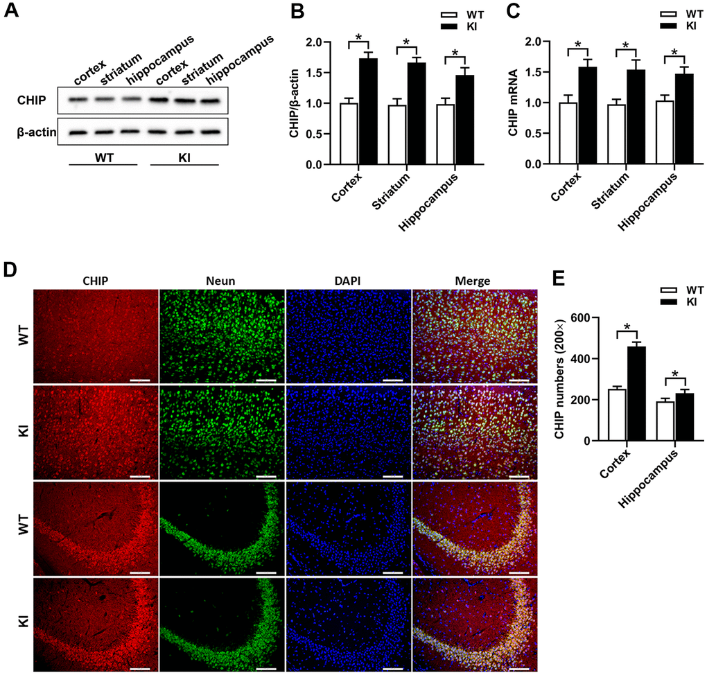 CHIP overexpression in CHIP KI mice. (A, B) Western blot and quantitative analysis of CHIP in the cortex, striatum, and hippocampus. (C) The mRNA expression of CHIP. (D) Immunostaining of CHIP, NeuN, and DAPI in the cortex and hippocampus of WT mice and CHIP KI mice. (E) Quantitative analysis of immunostaining showed the positive numbers of CHIP. WT, WT mice; KI, CHIP KI mice. Scale bar =100 μm. Data are presented as the mean ± SEM; n=6/group; *P 