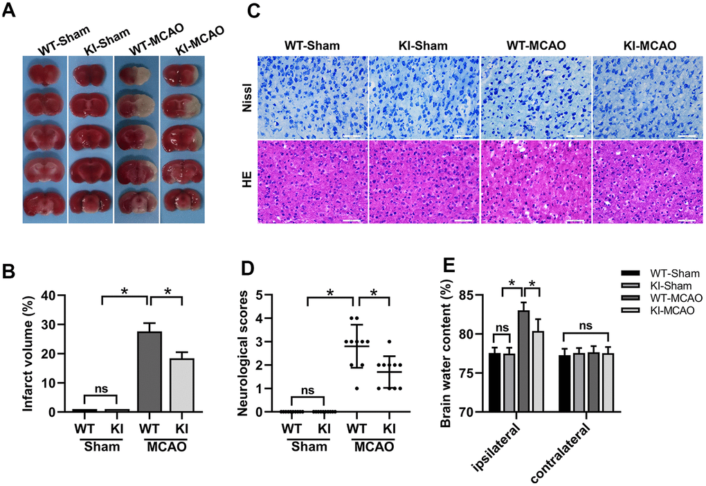 CHIP overexpression alleviated brain injury after MCAO. (A) TTC staining showed the cerebral infarct volume. (B) Quantitative analysis of the cerebral infarct volume. (C) HE and Nissl staining indicated the morphological characteristics. (D) Neurological scores. (E) Brain water content. Scale bar =50 μm. Data are presented as the mean ± SEM; n=6/each group and neurological scores n=10/each group; ns, no significant difference; *P 