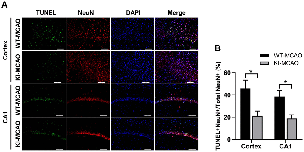 CHIP overexpression reduced neuronal cell death after MCAO. (A) TUNEL+ cells in the cortex and hippocampus CA1 regions were detected by TUNEL/NeuN staining after sham or MCAO surgery. (B) Quantitative analysis of total TUNEL+ ratio. Scale bar =100 μm. Data are presented as the mean ± SEM; n=6/group; ns, no significant difference; *P 