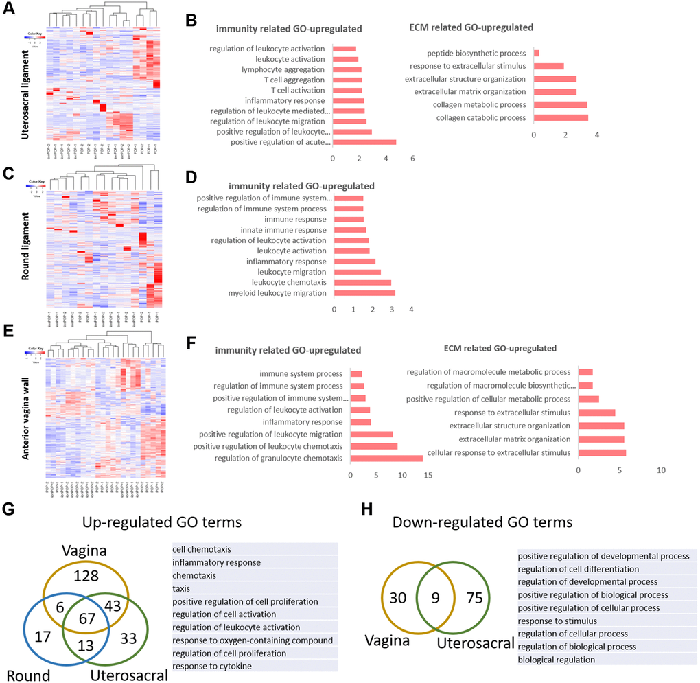 The molecular changes in pelvic tissue of pelvic organ prolapsed patients. (A, B) Heat map across all the samples using the top 500 most differently expressed genes (A) and gene ontology (GO) categories (B) of up-regulated differently expressed genes in uterosacral ligament between the prolapsed group and non-prolapsed group. (C, D) Heat map across all the samples using the top 500 most differently expressed genes (C) and gene ontology (GO) categories (D) of up-regulated differently expressed genes in round ligament between the prolapsed group and non-prolapsed group. (E, F) Heat map across all the samples using the top 500 most differently expressed genes (E) and gene ontology (GO) categories (F) of up-regulated differently expressed genes in vagina tissue between the prolapsed group and non-prolapsed group. (G) Venn diagram showing the overlaps of up-regulated differentially expressed genes enriched GO terms between vagina, round ligament and Uterosacral ligament, the top 10 GO terms also showed on the right side. (H) Venn diagram (left) and the form (right) showed the overlaps of down-regulated differentially expressed genes enriched GO terms between vagina and Uterosacral ligament.