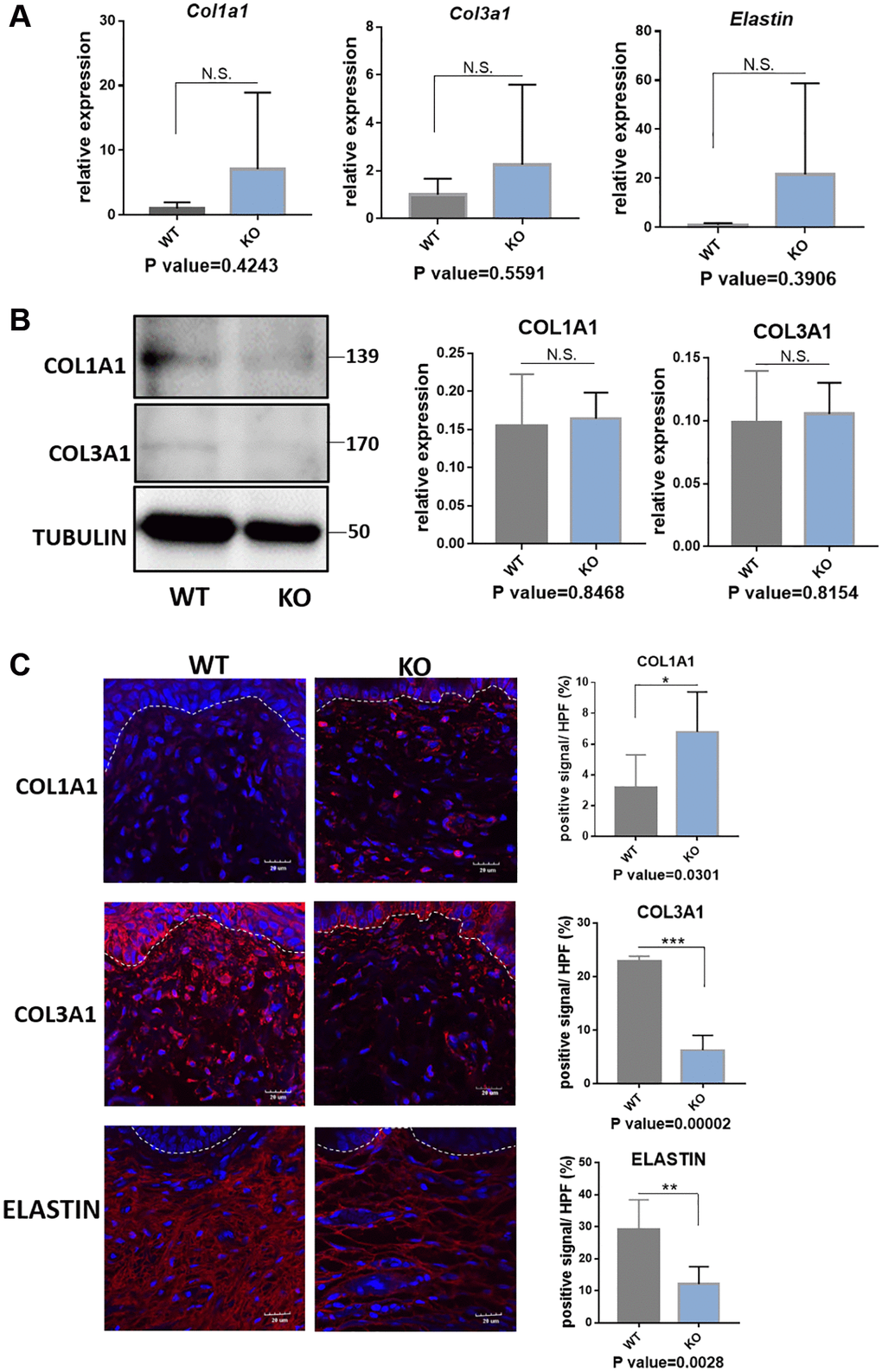 Quantification analyses of type I collagen, type III collagen and elastin in vagina tissue of Loxl1 knockout mice. (A) qRT-PCR analyses showed mRNA expression level of Col1a1, Col3a1 and Elastin in vagina tissue (WT: wild type mice, KO: Loxl1 knockout mice, n = 3 in each group). (B) Western blots analyses of COL1A1 and COL3A1 in vagina tissue. Relative content of proteins were quantified on the right, the levels of protein expressed relative to TUBULIN, (n = 3 in each group). (C) Immunofluorescence staining for visualization (red) of COL1A1, COL3A1 and ELASTIN in vagina tissue (White dotted line indicated the interface between mucus layer and submucosa layer). The proportion of positive signal area (red) in each High Power Field of vision (HPF) of each protein were quantified on the right, (n = 6 in each group).