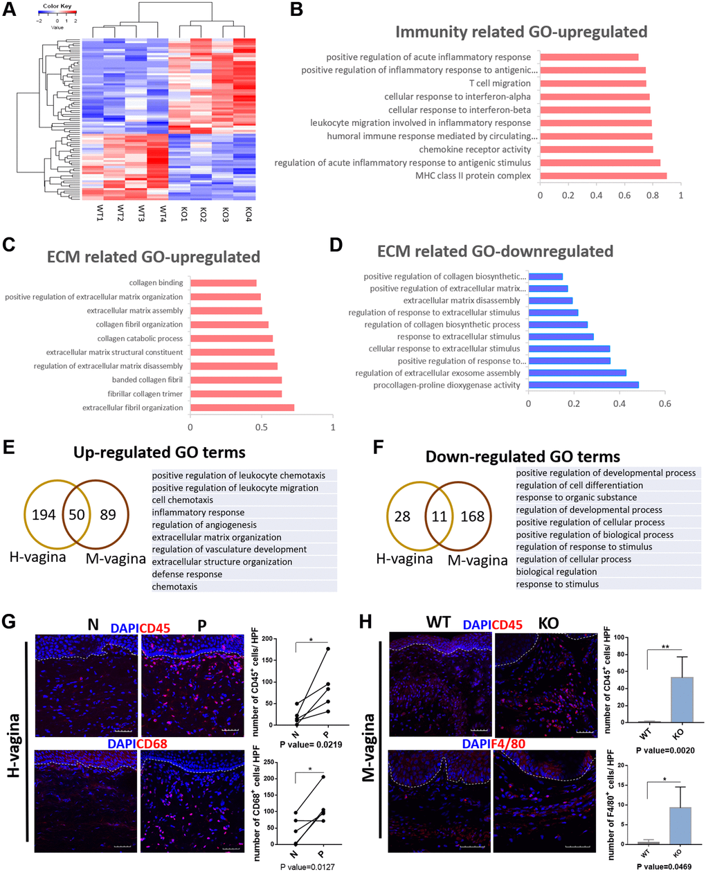 Loxl1 knockout mice recapitulate the molecular changes in vagina tissue of clinical POP. (A) Heat map across all the samples using the top 500 most differently expressed genes in vagina tissue between the Loxl1 knockout mice and WT mice. (B–D) gene ontology categories of differently expressed genes, horizontal axis represent the fold enrichment, p value E, F) Venn diagram (left) and the form (right) showed the overlaps of up-regulated (E) and down-regulated (F) differentially expressed genes enriched GO terms between human vagina (H-vagina) and mice vagina (M-vagina). (G, H) Immunofluorescence staining for visualization (red) of immune cell infiltration in human vagina (G) and mice vagina (H). The number of positive cells (red) in each High Power Field of vision (HPF) were quantified respectively. (CD45: leukocyte, CD68: macrophage in human, F4/80: macrophage in mice; White dotted line indicated the interface between mucus layer and submucosa layer, n = 5 in each group).