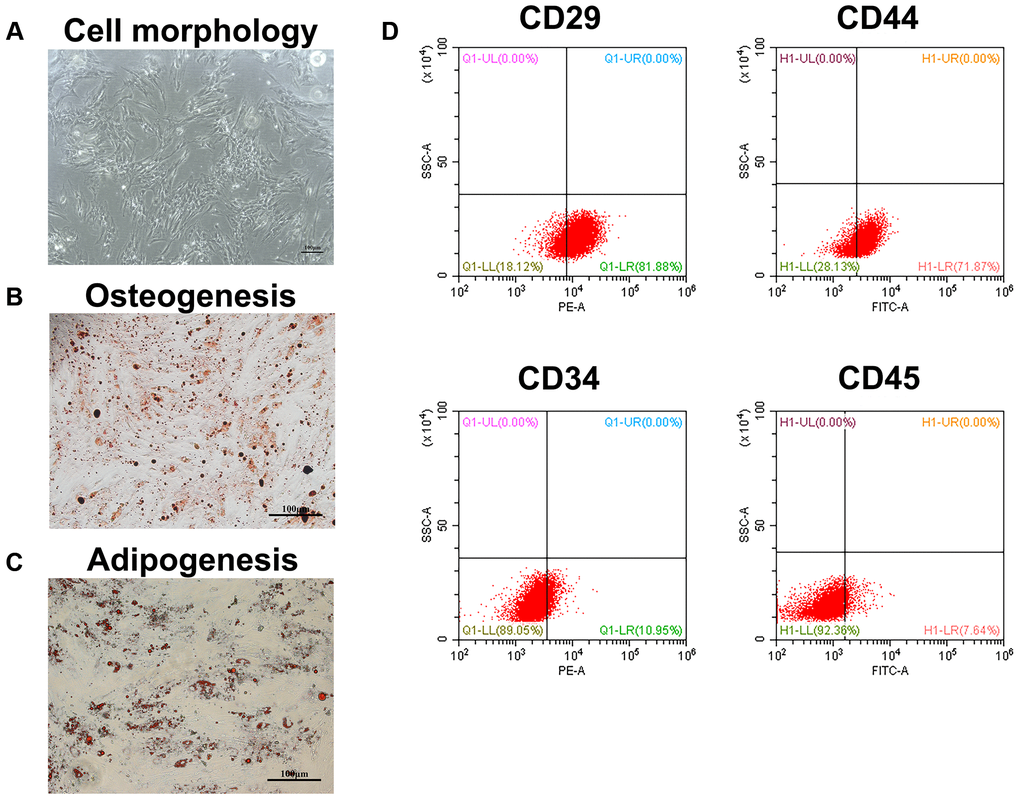 Identification of BMSCs. (A) The appearance of BMSCs cultured to the second generation. Scale bar = 100 μm. (B) The osteogenesis differentiation of BMSCs was confirmed by alizarin red staining. Scale bar = 100 μm. (C) The potential of BMSCs to differentiate into adipocytes was verified by oil red staining. Scale bar = 100 μm. (D) The surface markers of BMSCs were identified by flow cytometry.