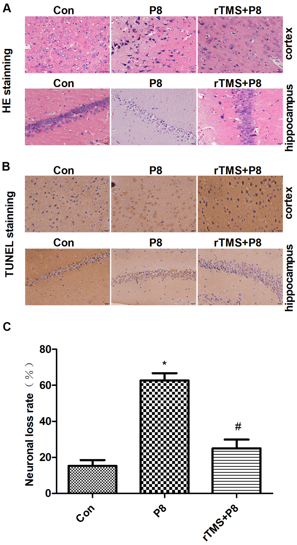 Reduction in neuronal loss in the cortical and hippocampal neurons of P8 mice after rTMS treatment. (A) The changes in the morphology of cortical and hippocampal neurons in mice were evaluated by HE staining (scale bar, 20μm). (B) TUNEL staining was performed for the mouse cortical and hippocampal regions (scale bar, 20μm, magnification, 10x eye piece x 40x objective). (C) Histogram analysis of TUNEL-positive cells. The data is demonstrated as the mean ± standard deviation (n =5). *P 