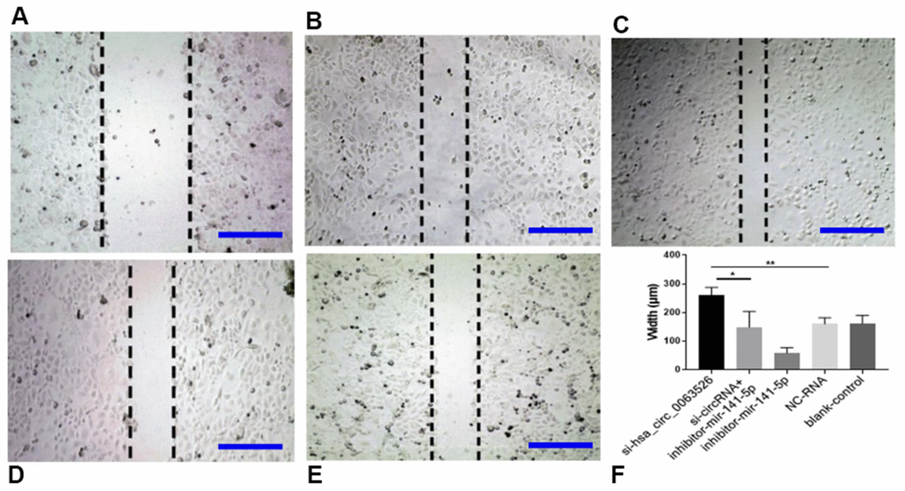 Wound-healing test on the effect of inhibition of hsa