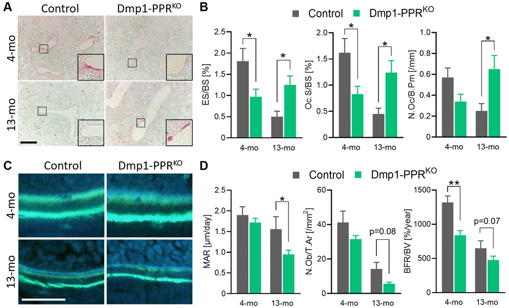 Histomorphometric analysis of trabecular bones of Dmp1-PPRKO mice. (A, B) Representative TRAP staining images and bone resorption parameters of the distal femora from male control and KO animals. The inset shows a closeup displaying the TRAP-positive osteoclasts on the trabecular bone surface. Bar = 200 μm. (C) Representative images of calcein double-staining on the distal femora of these mice. Bone formation within 7 days was visualized by double calcein labeling. Bar = 50 μm. (D) Representative bone-formation parameters of the distal femora are shown. See Table 1 for the full list of resorption and formation parameters. N = 6–10 per group. Analyses were performed in a blinded fashion. Unpaired Student’s t test was performed. *p **p 