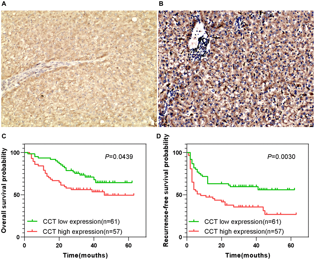 Prognostic value of CCT7 protein expression in a cohort of 118 HCC patients. (A, B) Representative images from immunohistochemical staining of HCC tissues with low (A) or high (B) CCT7 protein expression (×200 magnification). (C, D) Higher CCT7 protein expression was associated with worse OS (C) and RFS (D).