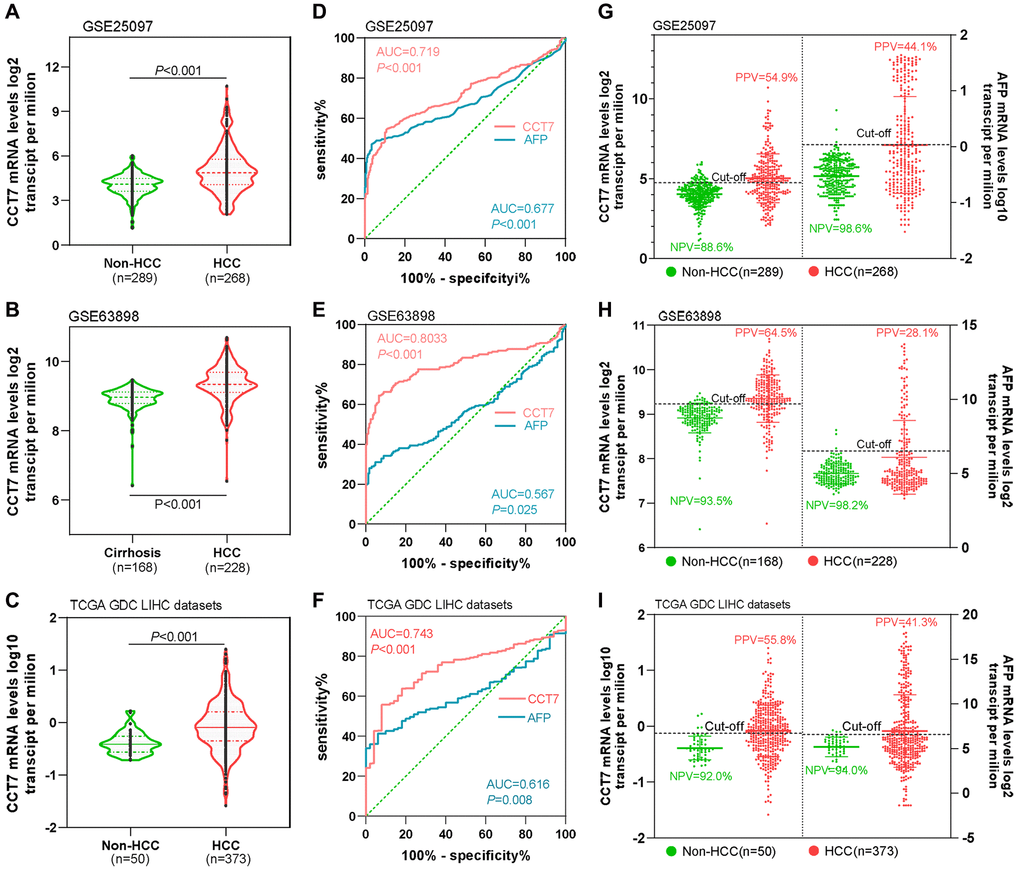 CCT7 has a higher PPV than AFP for HCC diagnosis. CCT7 mRNA levels were significantly greater in HCC than in non-HCC tissues in GSE25097 (A), GSE63898 (B) and TCGA LIHC datasets (C). In ROC curve analyses, CCT7 had a significantly higher AUC than AFP in the GSE25097 (0.719 vs. 0.677, D), GSE63898 (0.803 vs. 0.567, E) and TCGA LIHC datasets (0.743 vs. 0.616, F). CCT7 had a higher PPV than AFP in the GSE25097 (54.9% vs. 44.1%, G), GSE63898 (64.5% vs. 28.1%, H) and TCGA LIHC datasets (55.8% vs. 41.3%, I).