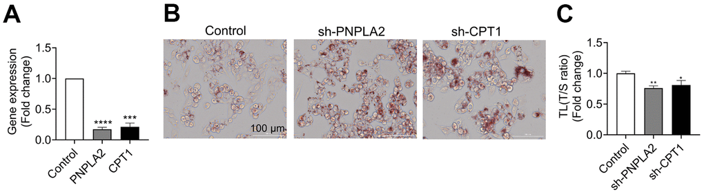 Knockdown of genes for lipid metabolism shortened telomere length (TL) in HepG2 cells.PNPLA2 and CPT1 genes were knocked down by short-hairpin RNA (shRNA) in HepG2 cells. (A) Efficiency of gene knockdown by short-hairpin RNA (shRNA) was evaluated by qPCR. (B) Oil red O staining in HepG2 cells after PNPLA2 and CPT1 knockdown by shRNA. (C) TL was determined by qPCR in HepG2 cells. Data were expression as mean±SEM. *p