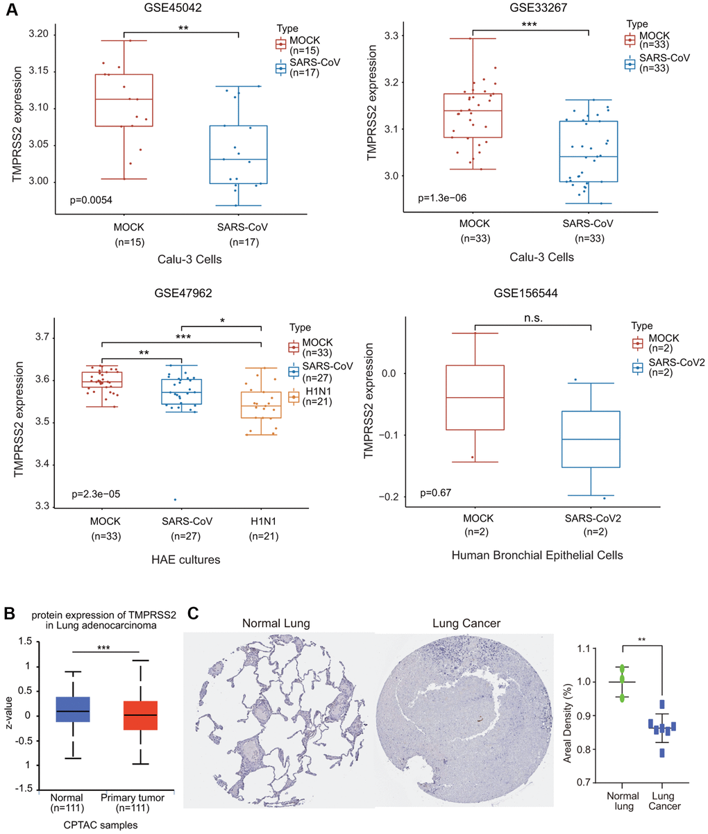 The alteration of TMPRSS2 expression during SARS-CoV-2 infection. (A) The change in TMPRSS2 expression in the GSE45042 (mock, n = 15; SARS-CoV, n = 17), GSE33267 (mock, n = 33; SARS-CoV, n = 33), GSE17962 (mock, n = 33; SARS-CoV, n = 27; H1N1, n = 21), and GSE156544 (mock, n = 2; SARS-CoV2, n = 2) datasets. (B) TMPRSS2 protein levels in lung cancer tissues (n = 111) and normal tissues (n = 111) from the UALCAN database. (C) TMPRSS2 protein level in lung cancer and normal tissues from the HPA database. The staining was quantified (normal lung tissue, n = 3; lung cancer, n = 7). *p **p ***p 