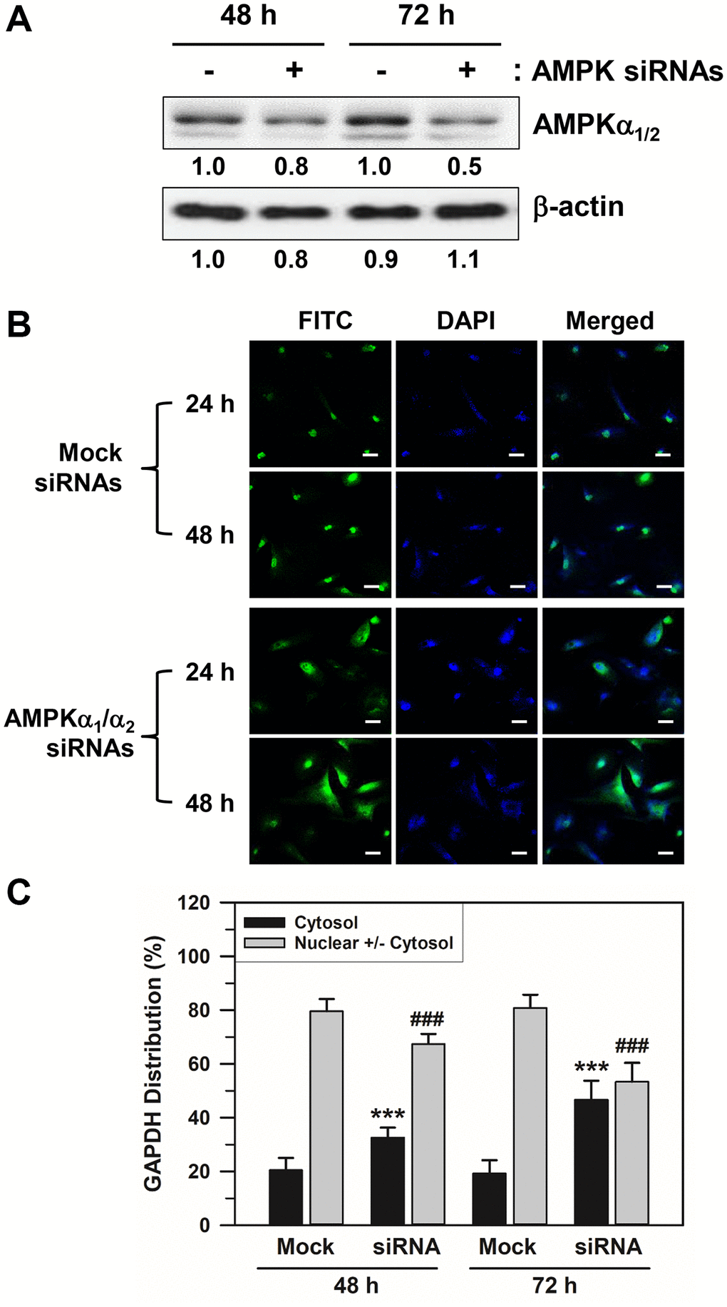 Effects of AMPKα siRNA transfection on the nuclear accumulation of GAPDH in senescent HDFs. Senescent HDFs were transfected with control scrambled siRNA duplexes (−) or siRNAs against AMPKα1/2 (+) for 48 and 72 h in DMEM with 10% FBS. (A) Cells were harvested at the indicated times after transfection, and lysates containing the same amount of protein (45 μg) were assessed by western blot analysis using polyclonal anti-AMPKα1/2 and anti-β-actin antibodies. The band densities were normalized against β-actin and the fold changes of AMPKα1/2 in AMPKα siRNA-transfected cells (+) compared to that of scrambled siRNA-treated control cells (−) are written under each band. (B) Cells were immunostained against GAPDH and analyzed by confocal laser scanning microscopy (magnification, 100×; scale bar, 50 μm). (C) The number of cells with cytosolic GAPDH alone (Cytosol) and cells having nuclear GAPDH with or without cytosolic GAPDH (Nuclear +/− Cytosol) was counted, and the percentage distributions were calculated (n = 40 for total replicates) and plotted as means ± standard deviations. ***p ###p 