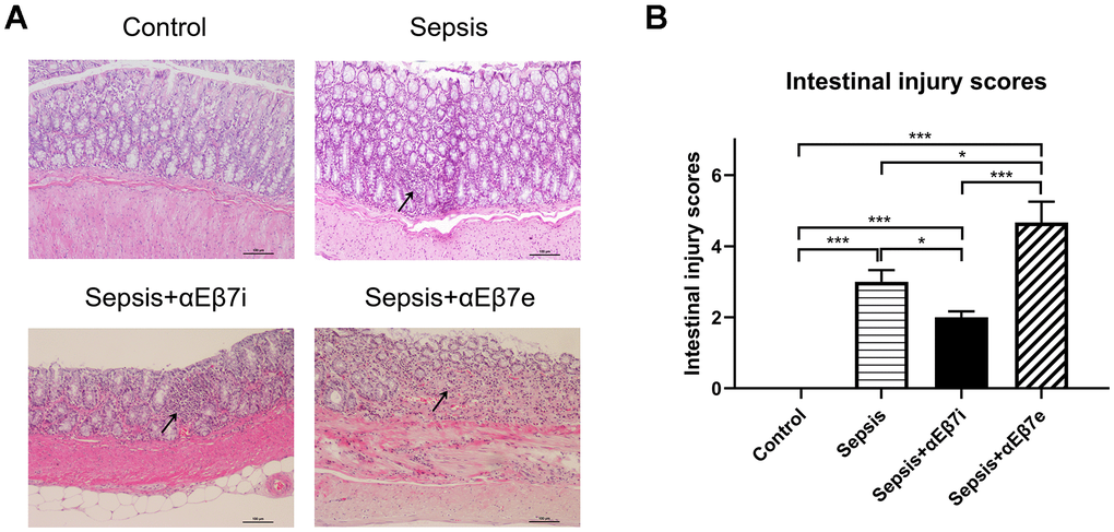 (A) The hematoxylin and eosin stain of intestinal mucosa in rats of control cohort, sepsis cohort, sepsis+αEβ7i cohort, and sepsis+αEβ7e cohort, respectively. (B) The intestinal injury scores of rats among the four cohorts. * P P P 