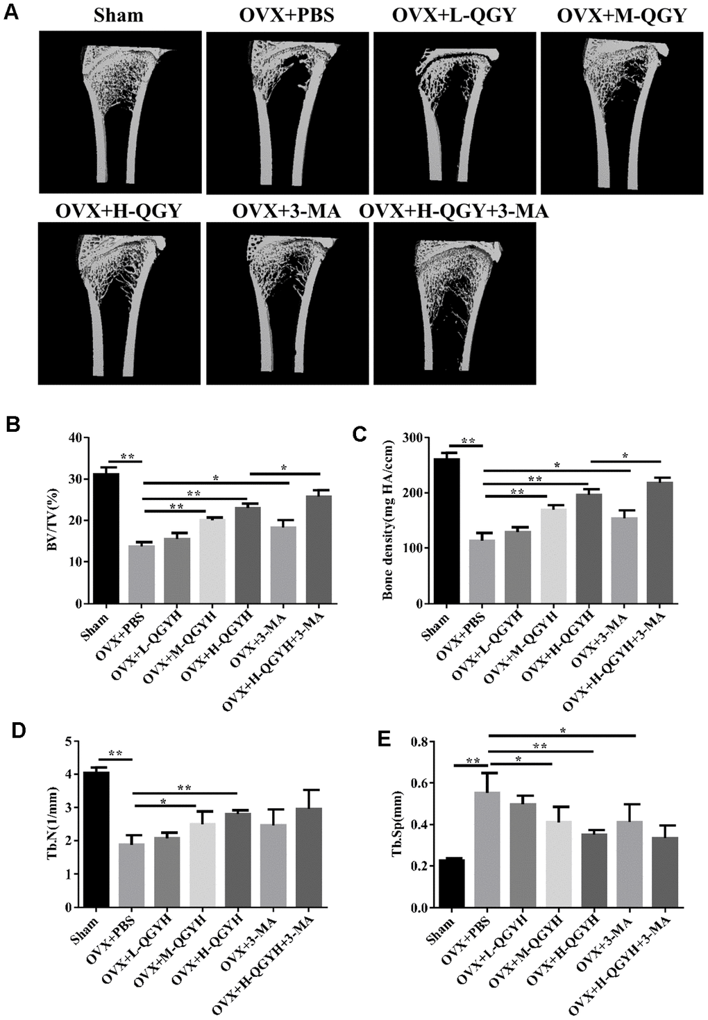 Micro-CT analysis after treating with QGY in animal model. Ovariectomy (OVX) was performed in rats, and then different doses of QGY were given to the rats. (A) Representative figures of three-dimensional micro-CT analysis. (B–E) Quantitative analysis of bone trabecular volume fraction (BV/TV, %) (B), bone density (BMC/TV) (C), bone trabecular number (Tb.N) (D) and bone trabecular spacing (Tb.Sp, mm) (E) in three-dimensional micro-CT analysis. The data are presented as the means ± SD (n=5). *p**p