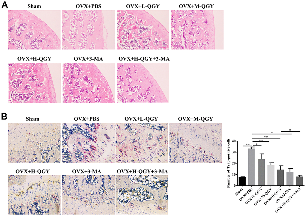 Staining analysis after treating with QGY in animal model. (A) H&E staining of the trabecular bone. (B) TRAP staining and quantitative analysis of the trabecular bone. The data are presented as the means ± SD (n=5). *p**p