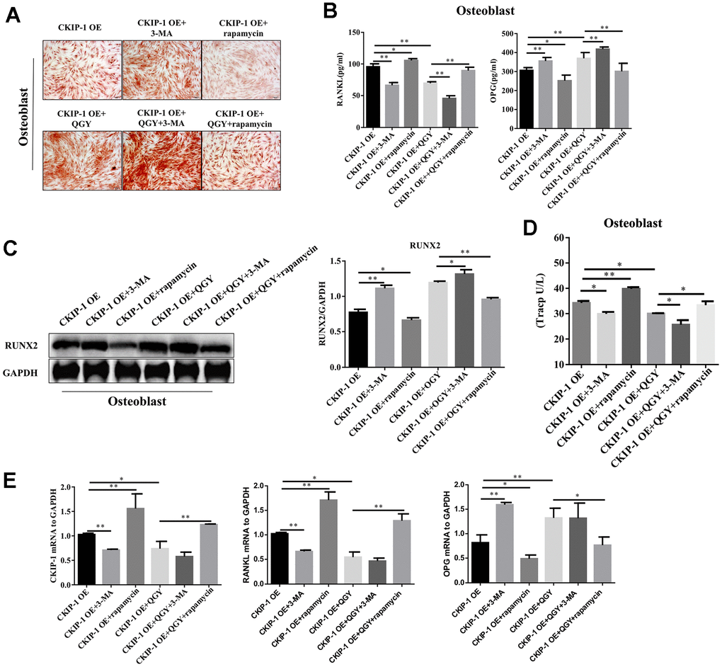 CKIP-1 mediated autophagy on the differentiation and function. (A) Alizarin Red Staining in the osteoblasts. (B) RANKL and OPG content analysis in the osteoblasts. (C) Representative figures and quantitative analysis of protein expression of RUNX2 in the osteoblasts. (D) TRACP activity analysis in the osteoblasts. (E) Gene expression levels of CKIP-1, RANKL and OPG in the osteoblasts. The data are presented as the means ± S.D (n=6). *p**p