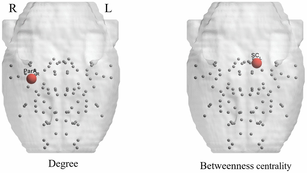 Significant differences in nodal parameters are shown by 3D schematic Figures, corresponding to Table 3. Red nodes indicate significant decreases in the aged group compared with the young group.