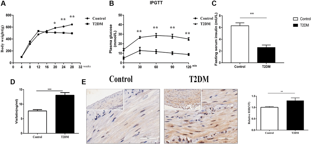 Evaluation of the animal model. (A) Body weight following an injection of STZ in the control and treatment groups. (B) Glucose tolerance test results in the two groups at 18 w. (C) Fasting serum insulin level in the two groups at 18 w. (D) Serum VF levels in the two groups at 18 w. (E) Immunohistochemical staining of VF in the colon muscle layers in the two groups at 8 w. Left panel: Representative image; right panel: Quantitative analysis. Low magnification, 200×, scale bar = 100 μm; high magnification, 400×, scale bar = 50 μm. *P **P ***P n = 10, T2DM group n = 8.