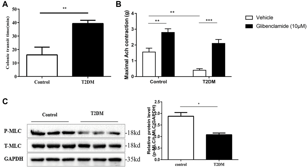 Colonic motility dysfunction of T2DM rats. (A) Distal colonic transit time at 8 w following an injection of STZ in the diabetic and control groups. (B) Distal colonic strips of diabetic and control rats were treated with vehicle (DMSO) or glibenclamide (10 μM). Quantification of maximum contractile force of a circular muscle strip stimulated by 10−4 mol/L ACh. (C) Western blotting analysis of the phosphorylation of MLC in the colon muscle layers. Relative expression was normalized to that of GAPDH. Left panel: Representative image; right panel: Quantitative analysis from three independent experiments. *P **P ***P n = 10, T2DM group n = 8.