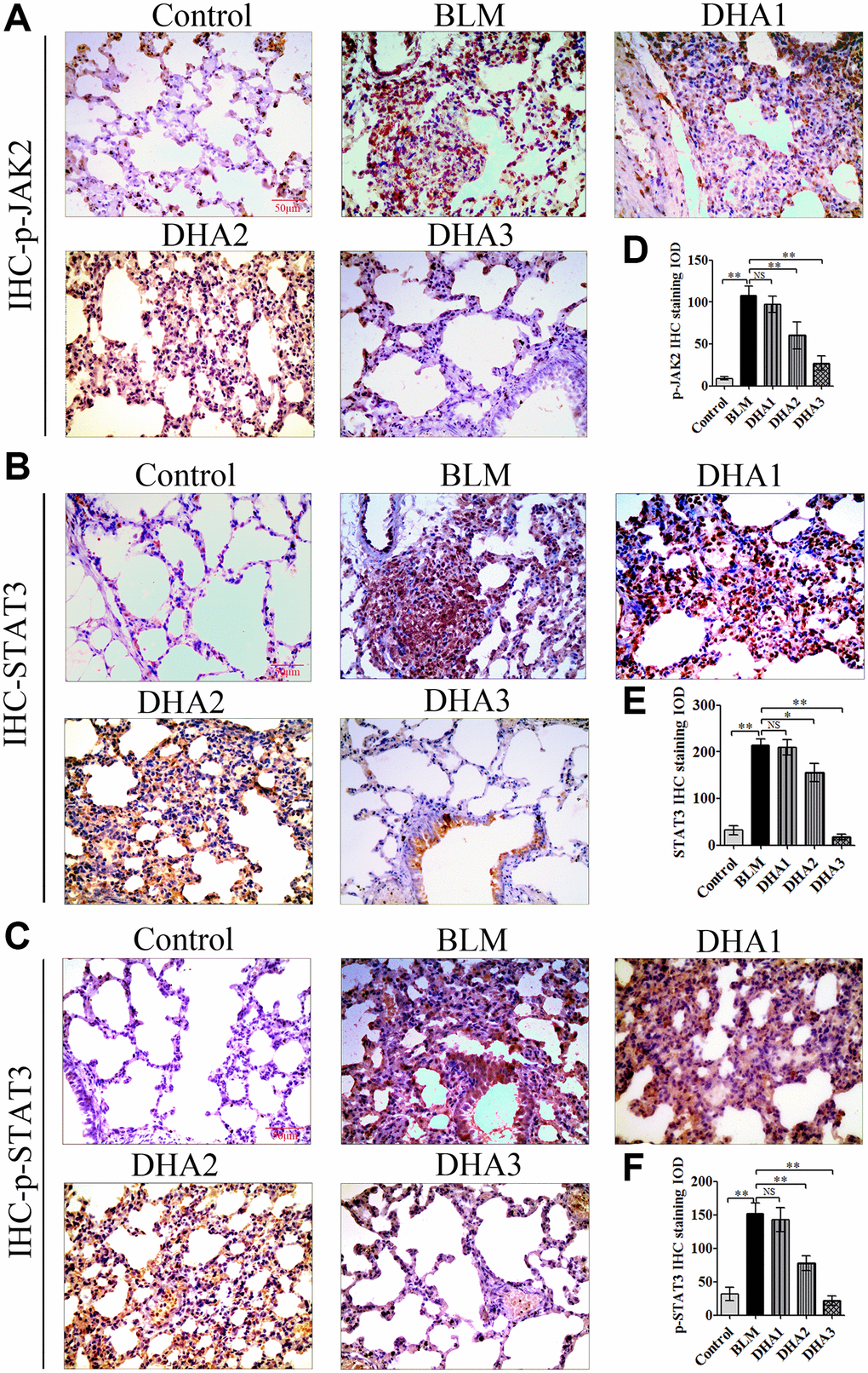 Representative images of (A) p-JAK2, (B) STAT3, and (C) p-STAT3 protein levels in lung tissue detected by IHC. Mean IOD of (D) p-JAK2, (E) STAT3, and (F) p-STAT3 protein by IHC staining. Data are expressed as the means ± standard error. *P **P 