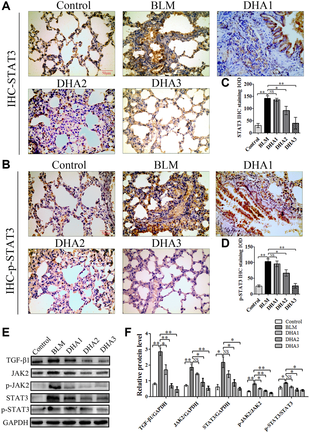 (A) STAT3, and (B) p-STAT3 protein in lung tissues, detected using IHC. Mean IOD of (C) STAT3, and (D) p-STAT3 IHC staining. Data are expressed as the means ± standard error. (E) and (F) Western blotting analysis of TGF-β1, JAK2, p-JAK2, STAT3, and p-STAT3 proteins in lung tissues. (All n = 6). *P **P 