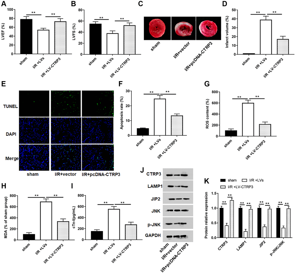 Overexpression of CTRP3 ameliorated I/R injury. (A, B) The levels of LVEF and LVFS were detected by echocardiograph as indexes for cardiac function at the end of the 24 h reperfusion. (C) Representative images of stained myocardial tissues of mice in all groups. (D) The percentage of myocardial infarction area of all groups. (E, F) Cardiomyocyte apoptosis was determined by using TUNEL assay. (G–I) The production of ROS, MDA and cTn-I was determined. (J,K) Western blotting was performed to analyze the protein expression of CTRP3, LAMPA, JIP2, JNK and p-JNK in myocardial tissue.