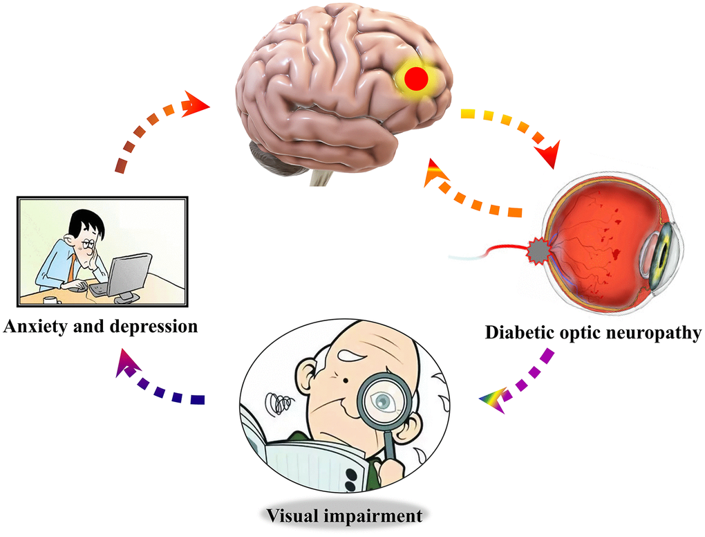 Relationship between cerebrum dALFF values of right middle frontal gyrus and mood state. Compared with HCs, dALFF values of right middle frontal gyrus were decreased in DON patients, which were more likely to undergo the anxiety and depression. Abbreviations: dALFF, dynamic amplitude of low-frequency fluctuation; HCs, healthy controls group; DON, diabetic optic neuropathy.