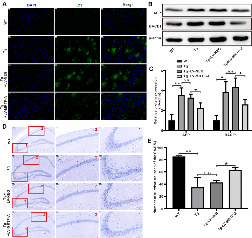 MRTF-A reduced Aβ-induced neurotoxicity in Tg2576 mouse hippocampus. (A) Representative image of staining with anti-Aβ (green) and DAPI (blue) in the CA1 areas of Tg2576 mice treated with LV-MRTF-A or not. (B, C) Western blot and quantitative analysis for APP and BACE1 genes. Data are presented as mean ± SEM from 5 mice per group, *P D, E) Nissl staining for the neuron morphological changes. The number of survival neurons of CA3 areas was analysis. Data represent means ± SEM from 5 mice per group, *P P P 