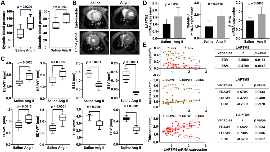 Assessment of Ang II infusion-induced HT with LVH mouse model. (A) Blood pressure measurement in Ang II-treated mice for 7 days. DBP represents diastolic blood pressure, while SBP indicates systolic blood pressure. (B) Representative end-diastolic and end-systolic cine MR images of LV from saline- and Ang II-treated mice for 7 days. (C) Quantitative changes in ESAWT, ESPWT, ESD, ESV, EDAWT, EDPWT, EDD, and EDV were compared between the two groups of mice. ESAWT, end-systolic anterior wall thickness; ESPWT, end-systolic posterior wall thickness; ESD, end-systolic diameter; ESV, end-systolic volume; EDAWT, end-diastolic anterior wall thickness; EDPWT, end-diastolic posterior wall thickness; EDD, end-diastolic diameter; EDV, end-diastolic volume. (D) RT-PCR analysis of the mRNA expression of LAPTM5, SM-MHC, and β-MHC between the two groups. (E) The Pearson correlation analysis between LAPTM5 and cardiac structural parameters of LV. The bottom table shows the correlation coefficients and p values. EDV, end-diastolic volume; ESV, end-systolic volume; EDAWT, end-diastolic anterior wall thickness; EDPWT, end-diastolic posterior wall thickness; EDD, end-diastolic diameter; ESAWT, end-systolic anterior wall thickness; ESPWT, end-systolic posterior wall thickness; ESD, end-systolic diameter.