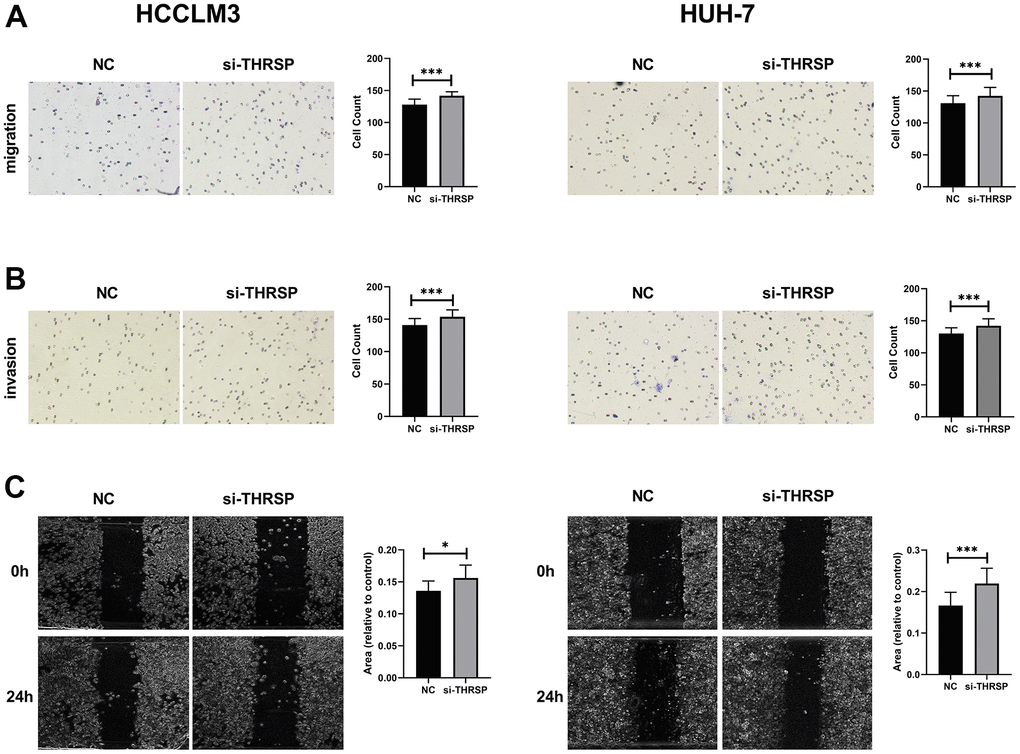 Transwell and wound healing assays. (A, B) The migration and invasion of HCCLM3 and Huh-7 cells detected by Transwell assays (magnification: 200×). (C) The migration ability of HCCLM3 and Huh-7 cells examined by wound healing assays (magnification: 40×).