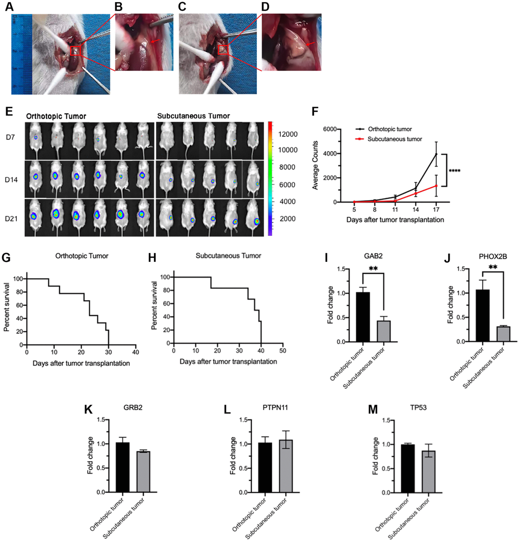 Comparison of tumorigenesis and gene expression between orthotopic and subcutaneous CDX models. (A–D) Illustration of orthotopic implantation. (A) Exposure of adrenal gland. (B) Local magnification of Figure 1A. (C) The expanded adrenal gland which is filled with tumor cells (20 μL). (D) Local magnification of Figure 1C. (E, F) Tumor growth measured by bioluminescence signals using in vivo imaging system. Representative bioluminescence images at the indicated time points (E) and tumor growth curves (F) (orthotopic, n = 6; subcutaneous, n = 5). (G, H) Survival curves of orthotopic (G, n = 8) and subcutaneous CDX mice (H, n = 8). (I–M) Relative expression of GAB2 (I), PHOX2B (J), GRB2 (K), PTPN11 (L) and TP53 (M) in orthotopic (n = 3) and subcutaneous tumor cells (n = 3). Data were normalized to the levels of orthotopic CDX mouse group. Data are presented as the mean ± SEM. **P ****P 