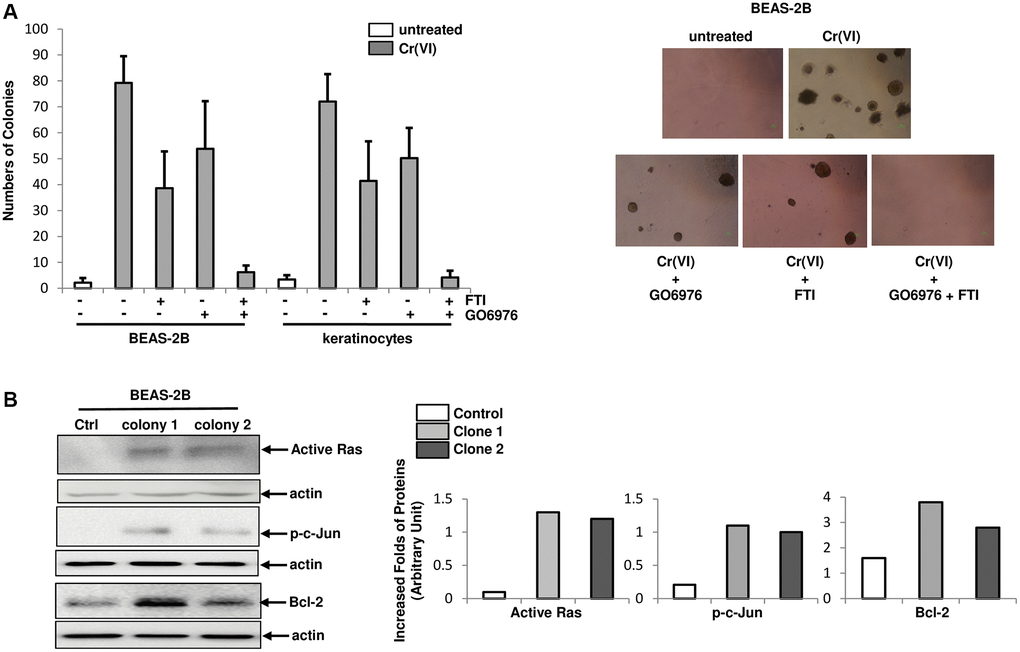 Role of PKC or Src/Ras signaling in Cr(VI)-mediated transformation. (A) Cells were cultured in soft agar containing Cr(VI) or Cr(VI) plus PP1, FTI or GO6976, respectively for another 4.5 months. Untreated cells grown in soft agar medium served as the control. The numbers of the colonies were counted (left panel) and examples of colonies from the treatments were imaged (right panels). The error bars were SD (n = 5, p B) Expression of active Ras, phosphorylated c-Jun and Bcl-2 in two Cr(VI) transformed colonies were examined by immunoblotting (left panels). The folds of the proteins induced were measured and then plotted (right panels). Actin was the loading control.