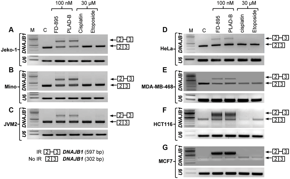 Intron retention of DNAJB1 gene in different cancer cell lines. Tumor cell lines were treated with 100 nM of FD-895, 100 nM pladienolide B, 30 μM cisplatin or 30 μM etoposide for 4 h. Analysis of IR of DNAJB1 mRNAs was evaluated by RT-PCR in (A–C) Mantle cell lymphoma cells, (Jeko-1, Mino and JMV-2), (D) HeLa, (E) MDA-MB-468 (F) HCT116 and (G) MCF-7 cells. RNU6A, an intronless gene was used as RNA quality and loading control.