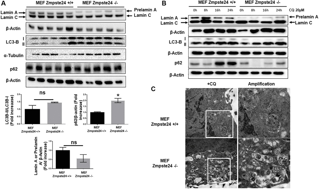 Immortalized MEF Zmpste24 KO cells present an increase in the basal autophagic flux. (A) Immunoblot analysis of Lamin A (in MEF Zmpste24 WT cells), prelamin A (in MEF Zmpste24 KO cells), LC3B II-I ratio and p62 using β actin as loading control, in the cell extracts in basal state (n = 5). The plot indicates the quantification data of Lamin A or prelamin A/β-actin ratio, p62/β-actin ratio and LC3B II/LC3B I ratio in the basal state. Data represent the mean ± standard error of the mean (SEM). Differences were determined by unpaired Student t-test analysis. *p n = 5). (B) Immunoblot analysis of Lamin A (in MEF Zmpste24 WT cells), prelamin A (in MEF Zmpste24 KO cells), LC3B II-I ratio and p62 using β actin as loading control, in the cell extracts treated with chloroquine (CQ) (20 μM) during 0, 8, 16 and 24 hours (n = 5). (C) Electron microscopy of MEF Zmpste24 WT and KO cells treated with CQ (20 μM) 24 hours. Enlargement of areas with accumulation of autophagosomes.