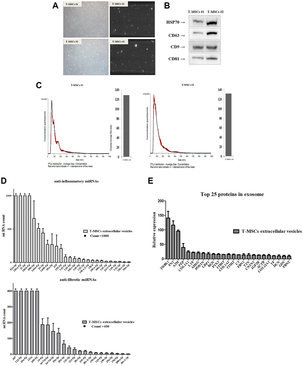 Identification of T-MSCs derived-extracellular vesicles. Nanoparticle tracking analysis of T-MSCs derived-extracellular vesicles. Normal cell (left) and screen shot from video of light scatter of placental vesicles overlaid with a graph of vesicle size and concentration, as determined by nanoparticle tracking analysis (right) (A). Western blot illustrating the characteristic surface markers of extracellular vesicles, HSP70, CD63, CD9, and CD81, present in the extracellular vesicles (B). Histogram of the nanoparticle tracking analysis demonstrating the size distribution of T-MSCs-derived extracellular vesicles after isolation through centrifugation (C). The presence of microRNA (miRNAs) in T-MSC-derived extracellular vesicles. T-MSCs-derived exosomes contain approximately 26 anti-inflammatory miRNAs and approximately 22 anti-fibrotic miRNAs (D). T-MSCs-derived extracellular vesicles contain 25 proteins (E).