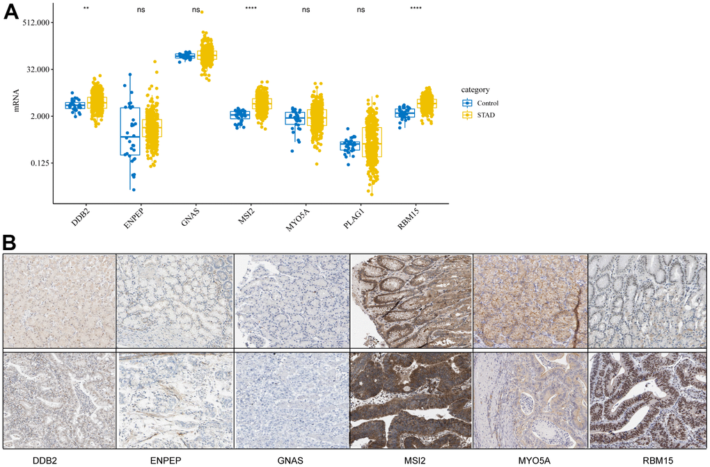 Expression levels of cancer driver genes (CDGs) and their alterations in gastric cancer (GC). (A) CDG mRNA expression levels in GC obtained from The Cancer Genome Atlas Stomach Adenocarcinoma (TCGA-STAD). (B) Expression levels of proteins encoded by CDGs in normal tissues as obtained from the Human Protein Atlas (HPA) database (Data for GLAP1 was not available at HPA database).