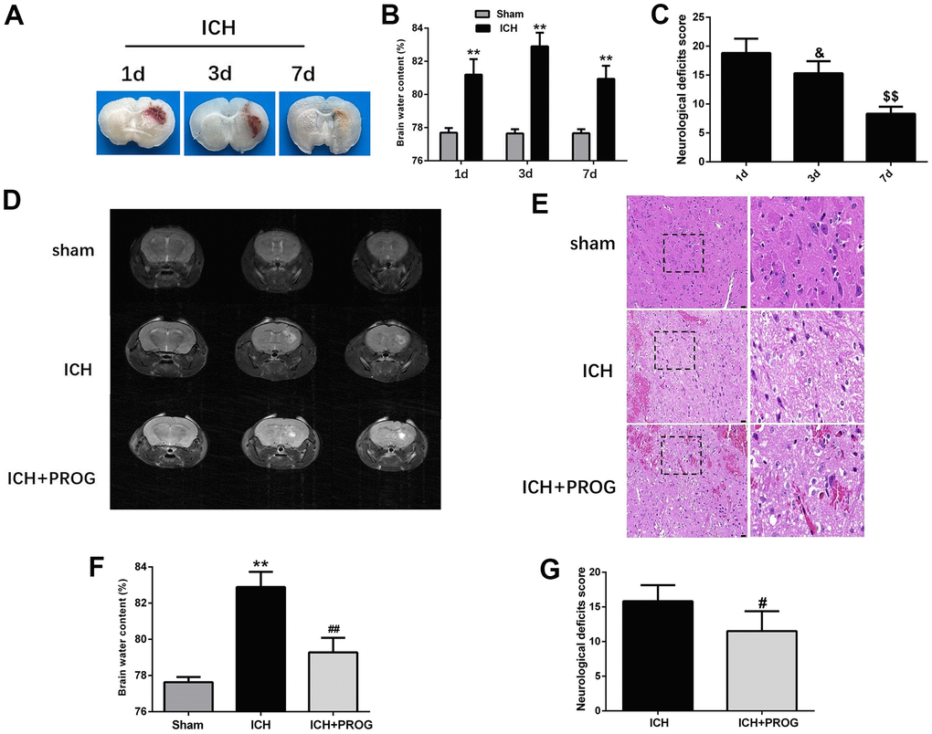 Time-dependence trend of hematoma absorption, neurological deficit, brain water content and the neuroprotective effect of progesterone. (A) Representative images of the brain tissues slices at 1, 3 and 7 days after ICH. (B) Brain water content at 1, 3, and 7 days after ICH. (C) Neurological deficit score at 1, 3, and 7 days after ICH. (D) Representative image of 7.0T MRI in each group. (E) The pathological injury was evaluated by hematoxylin-eosin (HE) staining. (F, G) On day 3 after ICH, progesterone treatment reduced brain water content and improved neurological deficit. n = 6 animals per group. Data are expressed as the mean ± SEM; **P #P ##P &P$$P