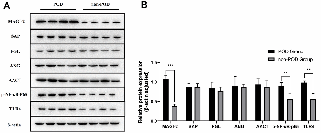 Proteomics-based validation of human peripheral blood. Based on the results of DIA proteomics and the hypothesis of this study, peripheral blood on the third postoperative day (T2) from eight POD patients and eight non-POD patients with DIA proteomics was validated by western blot analysis for selected differential proteins and the TLR4/NF-κB signaling pathway (A). The expression of MAGI-2 in the peripheral blood of POD patients was significantly higher than that of non-POD patients (B). TLR4/NF-κB pathway-related protein expression is shown in Figure 6B. Compared with non-POD patients, p-NF-κB-p65 and TLR4 were highly expressed in POD patients (B). POD: patients with postoperative delirium; non-POD: patients without postoperative delirium. Compared with non-POD group, *p