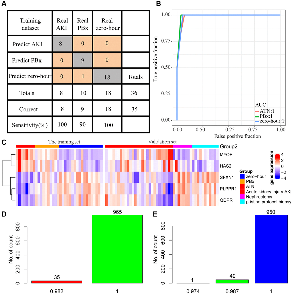 Construction of diagnostic model. (A) Prediction of AKI, PBx, and zero-hour in a diagnostic model constructed from 5 genes. (B) ROC curves for the prediction of AKI, PBx, and zero-hour in a diagnostic model constructed by 5 genes. (C) Expression patterns of the five genes in the training set and external test sets. (D) A thousand randomized validations of the distribution of predictive accuracy for nephrectomy samples and AKI samples in the validation set. (E) Thousands of random verifications in the verification set for the prediction accuracy distribution of stable kidney transplant samples and AKI samples.