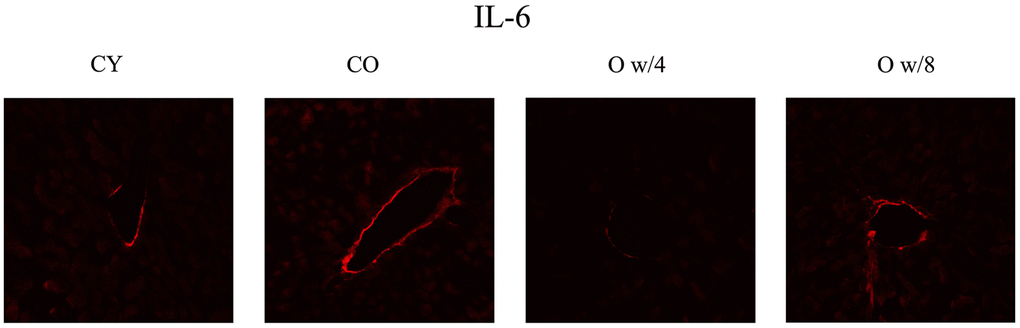 Immunofluorescence staining of the liver. Red signifies IL-6. IL-6 expression is observed along the wall of the interlobular vein. The 67-week-old mice joined with 4-week-old mice have decreased fluorescence compared to the 67-week-old mice joined with 8-week mice, suggesting that there is an effect of parabiosis on younger individuals. Abbreviations: CY: control young; CO: control old; O w/4: 67-week-old mice joined with 4-week-old mice; O w/8: 67-week-old mice joined with 8-week-old mice.