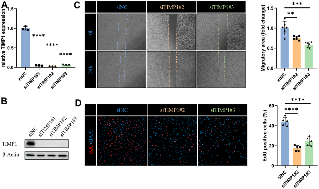 TIMP1 affects migration and proliferation of glioma cells. (A) qRT-PCR and (B) western blot analysis of TIMP1 knockdown efficiency in LN229 cells. (C) Representative images and statistical analysis of cell migration assay in control and TIMP1-deficient endothelial cells at the indicated times. (D) Representative images and statistical analysis of EdU assay in control and TIMP1-deficient LN229 cells. *, P