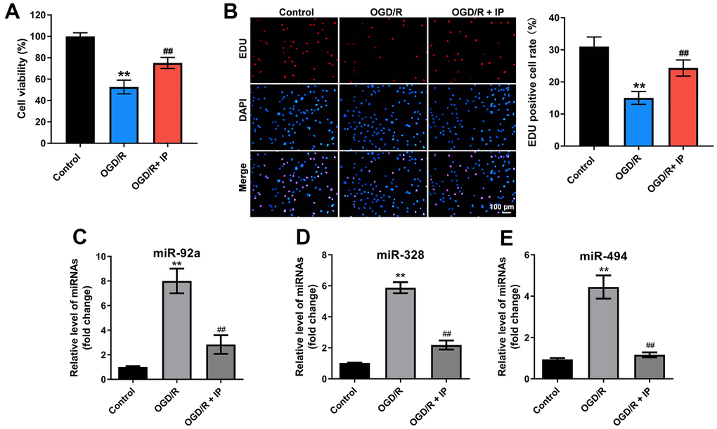 IP protected HUVECs against OGD/R via downregulating miR-92a, miR-328 and miR-494. To construct a model of OGD/R in vitro, HUVECs were cultured in glucose-free and serum-free DMEM at 95% N2 and 5% CO2 for 4 h. Then, HUVECs were cultured in DMEM containing 10% serum at 95% N2 and 5% CO2 for 18 h. (A) CCK-8 staining assay was used to detect the viability of HUVECs. (B) EdU staining assay was used to detect the proliferation of HUVECs. (C–E) RT-qPCR was performed to detect the expression of miR-92a, miR-328 and miR-494 in HUVECs. **P##P