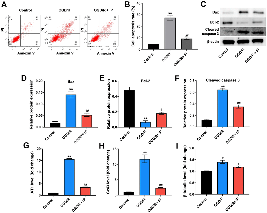 IP inhibited OGD/R-induced apoptosis of HUVECs via downregulating mRNA AT1, Cx43 and β-tubulin. (A, B) Flow cytometric analysis was performed to detect the apoptosis of HUVECs. (C–F) Western blot assay was used to detect the expression of Bax, Bcl-2 and cleaved caspase 3 in HUVECs. (G–I) RT-qPCR was performed to detect the expression of AT1, Cx43 and β-tubulin. *P#P##P