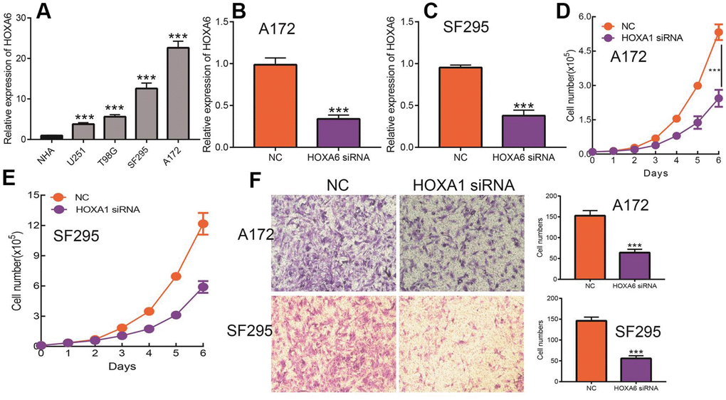 Knock down of HOXA6 inhibits LGG cell proliferation and migration. (A) The expression of HOXA6 in LGG cells lines examined by qRT-PCR assay. (B, C) The knock down efficiency of HOXA6 in LGG cells lines examined by qRT-PCR assay. (D, E) Depletion of HOXA6 inhibits LGG cells proliferation examined by growth curve assay. (F) Depletion of HOXA6 inhibits LGG cells migration examined by transwell assay.