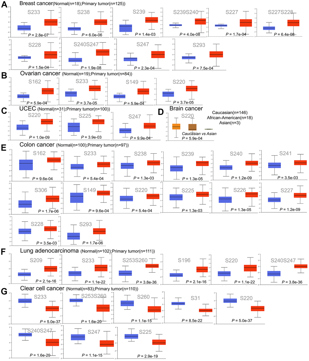 Phosphorylation of the HNRNPC protein in a variety of cancers. The UALCAN was used to compare the expression levels of HNRNPC phosphoprotein in normal and primary tissue using the CPTAC dataset. (A) Phosphorylation sites of HNRNPC proteins in breast cancer, including S233, S238, S239, S239S240, S227, S277S228, S228, S240S247, S247 and S293. (B) Phosphorylation sites of HNRNPC proteins in ovarian cancer, including S162, S233, S149 and S220. (C) Phosphorylation sites of HNRNPC proteins in UCEC, including S220, S225 and S247. (D) Phosphorylation sites of HNRNPC proteins in brain cancer, including S220. (E) Phosphorylation sites of HNRNPC proteins in colon cancer, including S162, S233, S238, S239, S240 and S241. (F) Phosphorylation sites of HNRNPC proteins in Lung adenocarcinoma, including S209, S233, S253S260, S196, S230 and S240S247. (G) Phosphorylation sites of HNRNPC proteins in clear cell cancer, including S233, S253S260, S260, S31, S220, S240S247, S247 and S255. Blue box plot: normal tissue; red box plot: tumor tissue; orange box plot: Caucasian; brown box plot: African-American; green box plot: Asian.