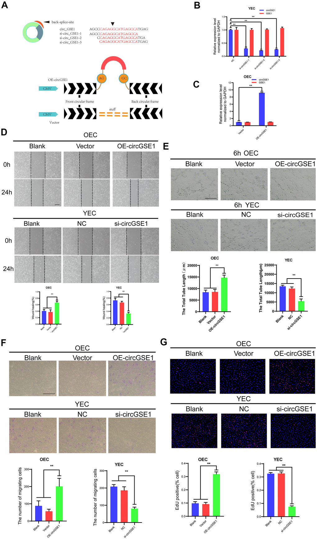 CircGSE1 promotes the proliferation, migration and tube formation of MAECs in vitro. (A) Schematic diagram of the circGSE1 siRNA and overexpression vectors. (B) qRT-PCR detection of YECs demonstrating successful knockdown of circGSE1; however, the linear GSE1 RNA expression was not altered significantly (n=3). (C) qRT-PCR detection demonstrating successful circGSE1 overexpression in OECs, while the linear GSE1 RNA expression was not changed significantly (n=3). (D) Wound healing assay of OECs treated with vector and OE-circGSE1, YECs treated with NC and si-circGSE1 (n=3, scale bar, 200 μm). (E) Tube formation assay of OECs treated with vector and OE-circGSE1, YECs treated with NC and si-circGSE1 (n=3, scale bar, 200 μm). (F) Migration assay of OECs treated with vector and OE-circGSE1, YECs treated with NC and si-circGSE1 (n=3, scale bar, 200 μm). (G) EdU assay of OECs treated with vector and OE-circGSE1, YECs treated with NC and si-circGSE1 (n=3, scale bar, 200 μm). (n=5, scale bar, 100 μm). (The data are expressed as the mean ± SD, *P 