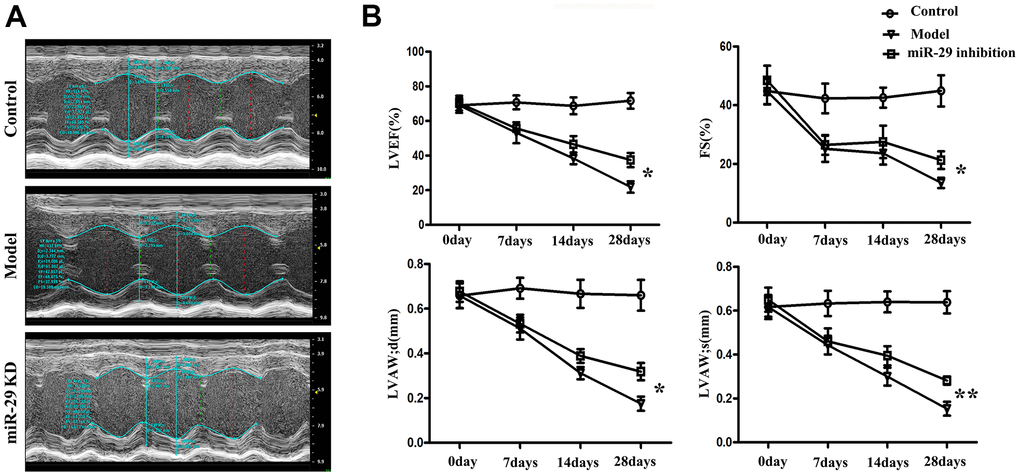 Effects of miR-29 on cardiac structure and function in vivo. (A) Echocardiography results showed that LVEF, FS (%) and LVAW (diastolic and systolic) were gradually decreased in miR-29 inhibition group and model group from 0 d to 28 d, respectively, and these diseases were more significant in model group than those in miR-29 inhibition group. (B) Result is displayed in terms of statistical chart. Data were presented as mean ± SE (*P