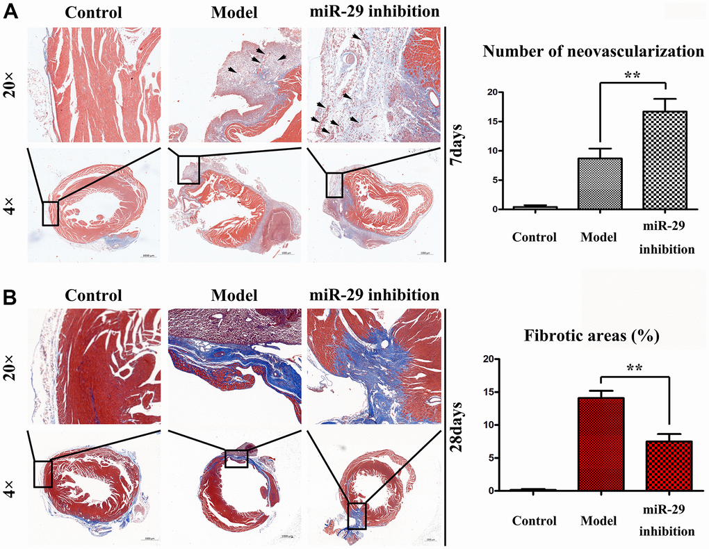 Effects of miR-29 on angiogenesis and fibrosis in vivo. The vessel sections were stained by hematoxylin and eosin. The section magnification was 4× and 20×, respectively. (A) H&E staining showed a higher degree of neovascularization (arrows) in miR-29 inhibition group than that in model group at 7 d, when the section magnification was 4×. (B) H&E staining showed less fibrotic areas in miR-29 inhibition group than those in model group at 28 d, when the section magnification was 4×. Results showed that miR-29 OE promoted angiogenesis and reduced fibrosis. Data were presented as mean ± SE (**P